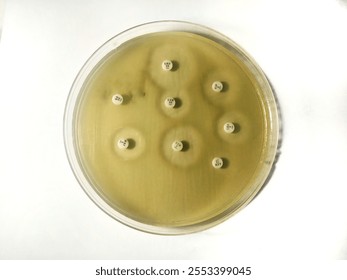 Salmonella typhi is a pathogenic bacterium responsible for causing typhoid fever, a serious and potentially life-threatening systemic illness. Below are key points about Salmonella typhi: