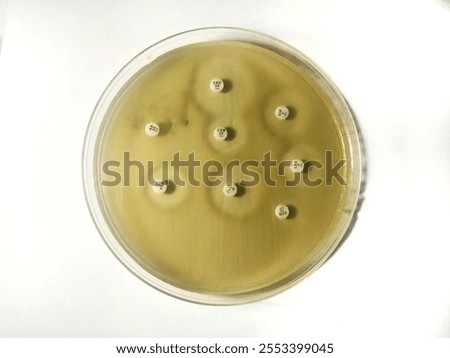 Salmonella typhi is a pathogenic bacterium responsible for causing typhoid fever, a serious and potentially life-threatening systemic illness. Below are key points about Salmonella typhi: