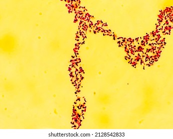 Salmonellosis: Microscopic View Of Gram Stained Slide From Blood Agar Salmonella Colonies, Show Salmonella Typhi (S. Typhi) Bacteria, Disease Is Referred To As Typhoid Fever.