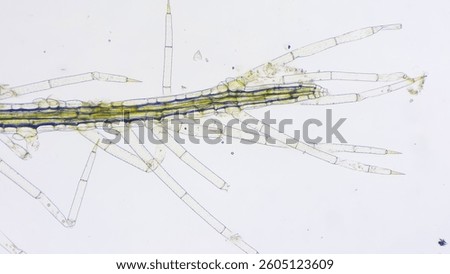 Salvinia minima root structures under microscope. Stacked photo
