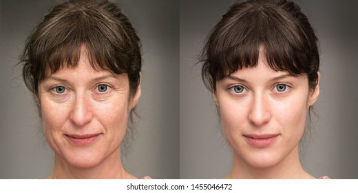 Same Face Of Woman Before And After A Rejuvenation Treatment. Wrinkles And Crow's Feet