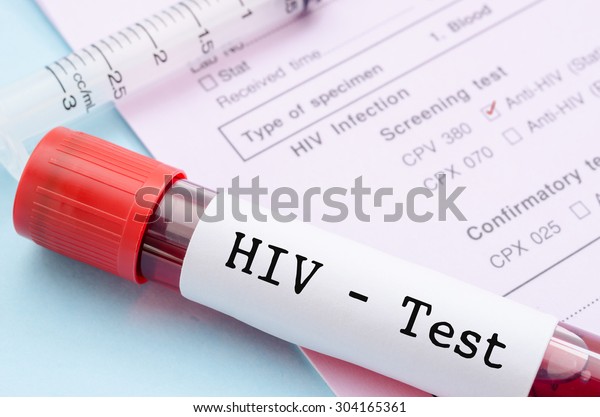Sample blood collection tube with\
HIV test label on HIV infection screening test\
form.