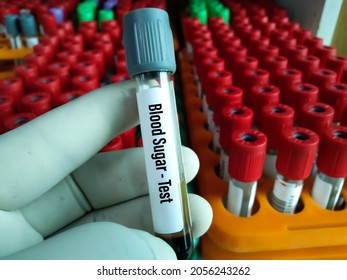 Sample Blood For Screening Diabetic Test In Blood Tube. To Blood Sugar Control Diagnosis At Lab.