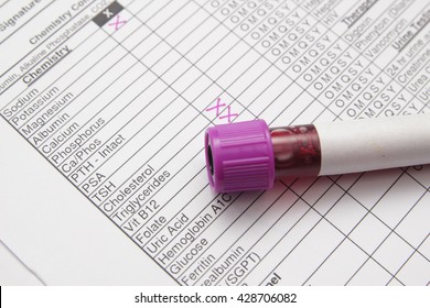 Blood Test Tube Chart