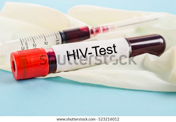 Sample blood for screening test for HIV test\
and syringe on glove in\
laboratory.