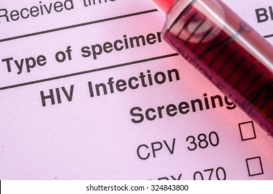 Sample Blood In Syringe On HIV Infection Screening Test Form.