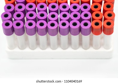 Rack Test Tubes Medical Laboratory Stock Photo 176629802 | Shutterstock