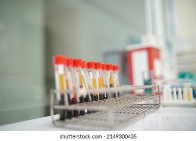 Sample Blood Tube In Rack For Analytical Testing HIV In Laboratory, Soft Focus.