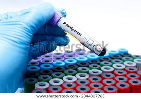 ฺิBlood sample of malaria patient positive test for plasmodium falciparum.