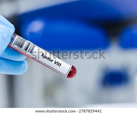 ฺBlood sample tube for factor VIII test analysis.