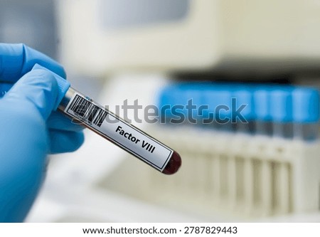 ฺBlood sample tube for factor VIII test analysis.
