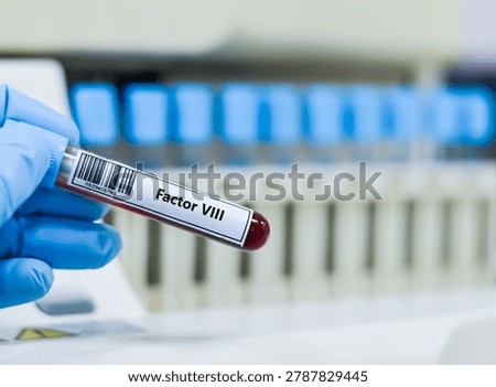 ฺBlood sample tube for factor VIII test analysis.
