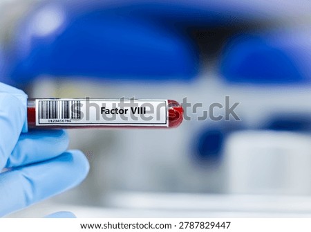 ฺBlood sample tube for factor VIII test analysis.