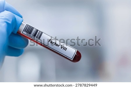 ฺBlood sample tube for factor VIII test analysis.