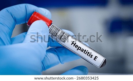 ิBlood sample tube for hepatitis E virus test analysis.