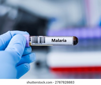 ฺBlood sample tube for malaria test analysis.