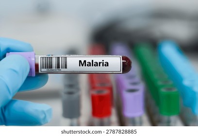 ฺBlood sample tube for malaria test analysis.