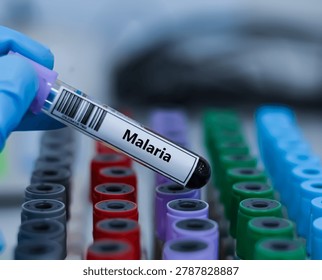 ฺBlood sample tube for malaria test analysis.