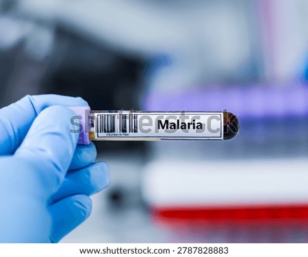 ฺBlood sample tube for malaria test analysis.