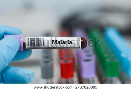 ฺBlood sample tube for malaria test analysis.