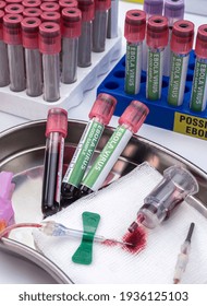 Sample vials of blood from possible Ebola patients infected with new Zaire strain of Ebola, concept image