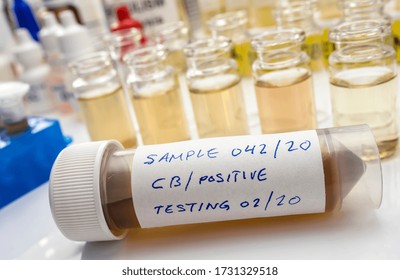 Samples Contaminated By Clostridium Botulinum Toxin That Causes Botulism In Humans, Laboratory Research, Conceptual Image