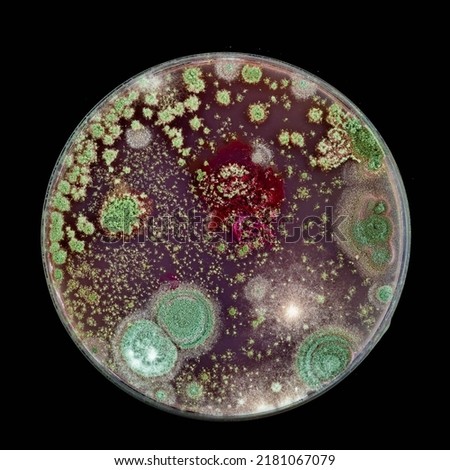 Samples of Petri dishes with a culture of microorganisms and fungi in the surface of agar nutrient medium