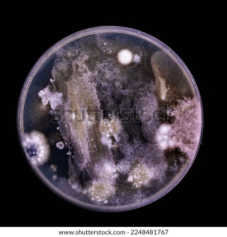 Samples of Petri dishes with a culture of microorganisms and fungi in the surface of agar nutrient medium