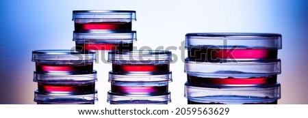 Samples in petri dishes in laboratory