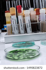 Samples you analyze of stuffed meat contaminated by bacterium of listeria in laboratory, sprout caused in Spain