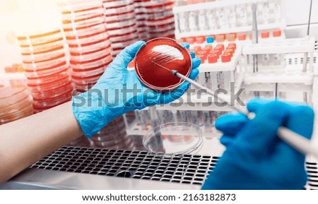 Sampling with bacteriological loop of material colonies microorganisms grown on dense nutrient medium for research.