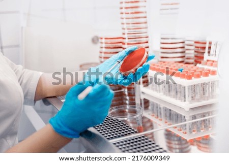 Sampling with bacteriological loop of material colonies microorganisms grown on dense nutrient medium for research.