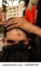 SANTIAGO, CHILE - NOVEMBER 1

A Protester Shows A Rubber Bullet Wound That He Just Got.