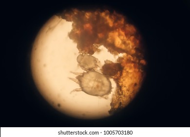 Sarcoptes Scabiei Or The Itch Mite  Parasitic Arthropod That Burrows Into Skin And Causes Scabies,view From Microscope