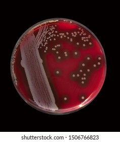 S.aureus,gram Positive Bacteria,growth On Blood Agar Plate 