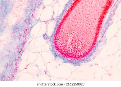 Scalp Hair Follicles Human Under Microscope Stock Photo 2162250823 ...