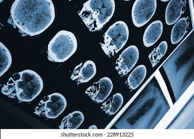 Scan Of The Brain And The Skull And Other Radiography Images