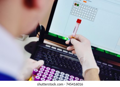 scanning bar code of test tubes in a bacteriological laboratory