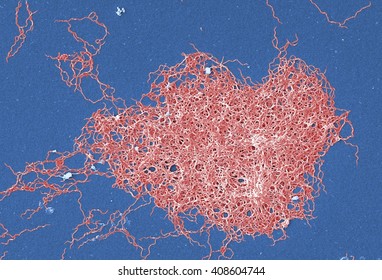 Scanning electron micrograph of Gram negative, anaerobic, Borrelia burgdorferi bacteria, which had been derived from a pure culture. This pathogenic organism is responsible for causing Lyme disease
