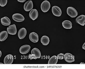 Scanning Electron Micrograph Of Lesser Celandine Pollen. Nottingham, UK