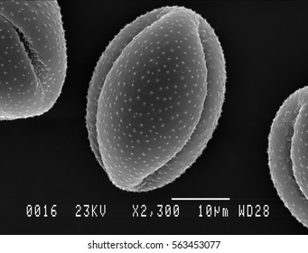 Scanning Electron Micrograph Of One Pollen Particle From Lesser Celandine Flower. Nottingham, UK. April.