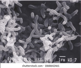 Scanning Electron Microscope Photo Of Vibrio Bacteria X8000