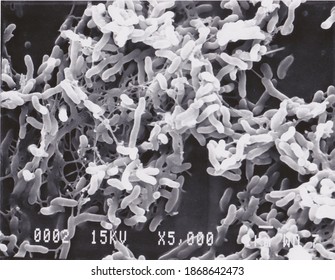 Scanning Electron Microscope Photo Vibrio Bacteria Stock Photo ...