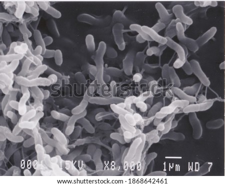 Scanning electron microscope photo of vibrio bacteria x8000