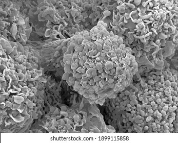 Scanning Electron Microscopy Of Single Human Cells. Extreme Close-up Of Mammalian Cell Surface Morphology. Erythrocytes, Connective Tissue And Collagen Fibres. 