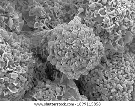 Scanning electron microscopy of single human cells. Extreme close-up of mammalian cell surface morphology. Erythrocytes, connective tissue and collagen fibres. 