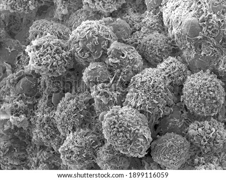 Scanning electron microscopy of single human cells. Extreme close-up of mammalian cell surface morphology. Erythrocytes, connective tissue and collagen fibres. 