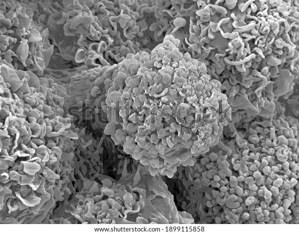 Scanning electron microscopy of\
single human cells. Extreme close-up of mammalian cell surface\
morphology. Erythrocytes, connective tissue and collagen fibres.\
