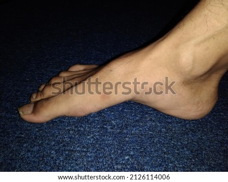 scar dark spot on asian foot