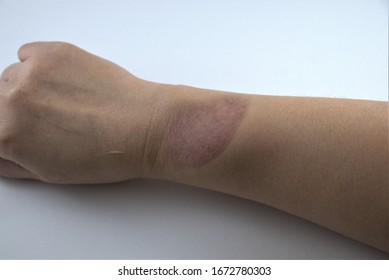 210 Dorsal wrist Images, Stock Photos & Vectors | Shutterstock